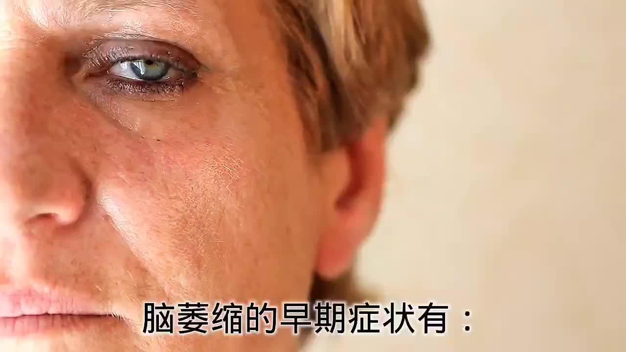 小脑萎缩初期有什么症状