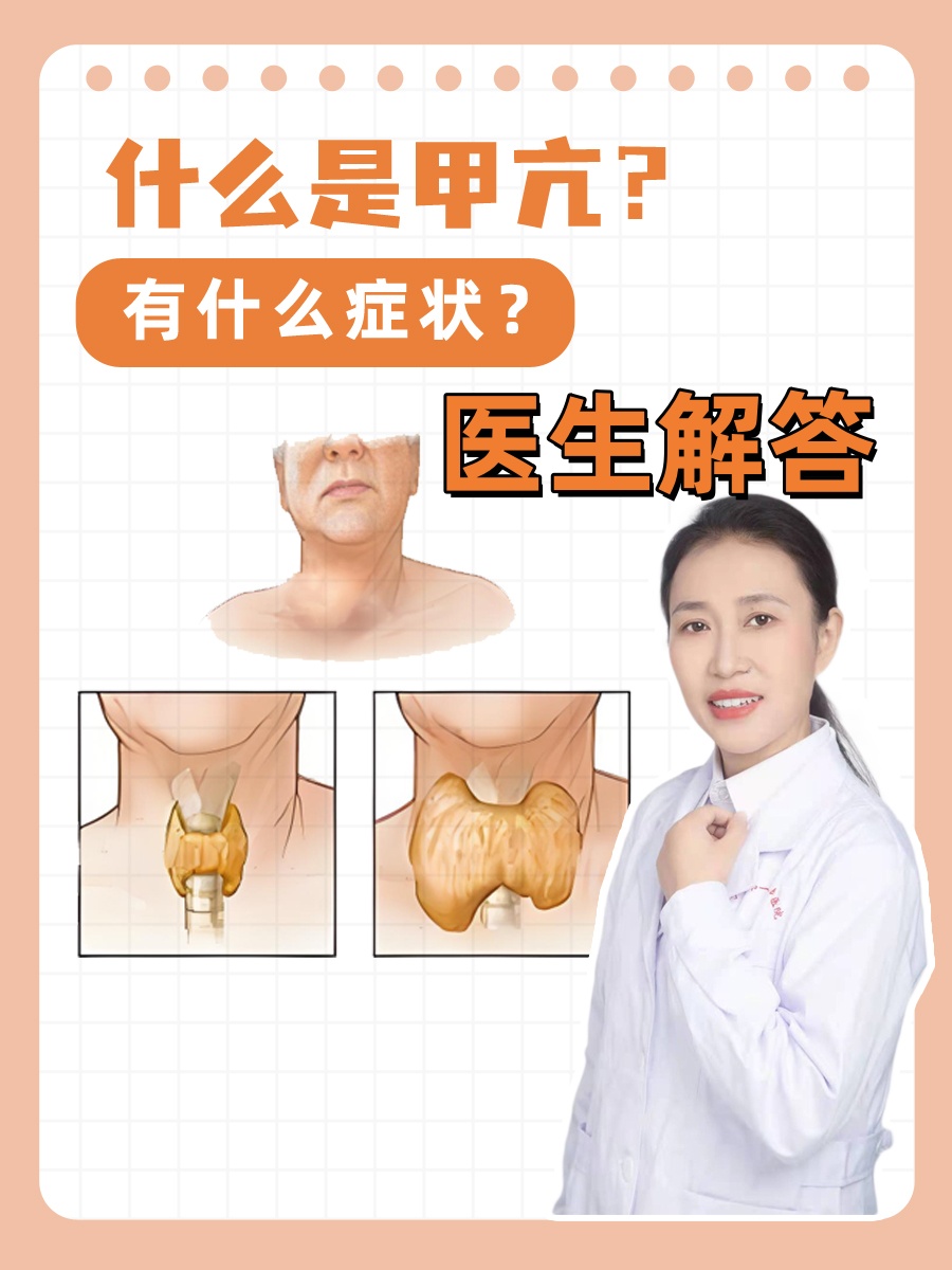 甲亢的表现症状有哪些