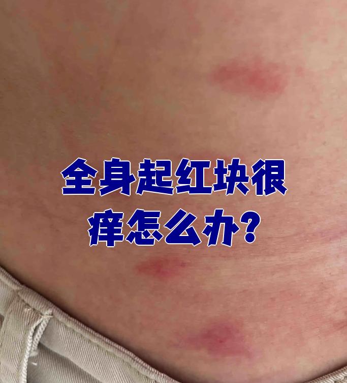 浑身发痒怎么回事?
