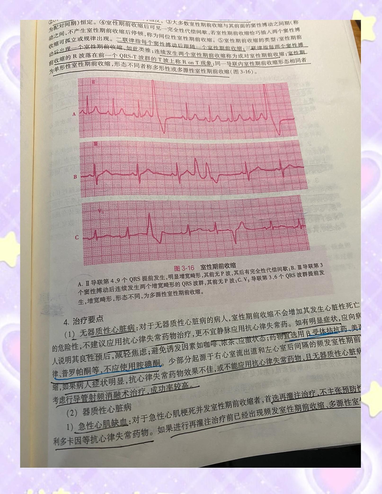 窦性心律不齐是什么原因引起