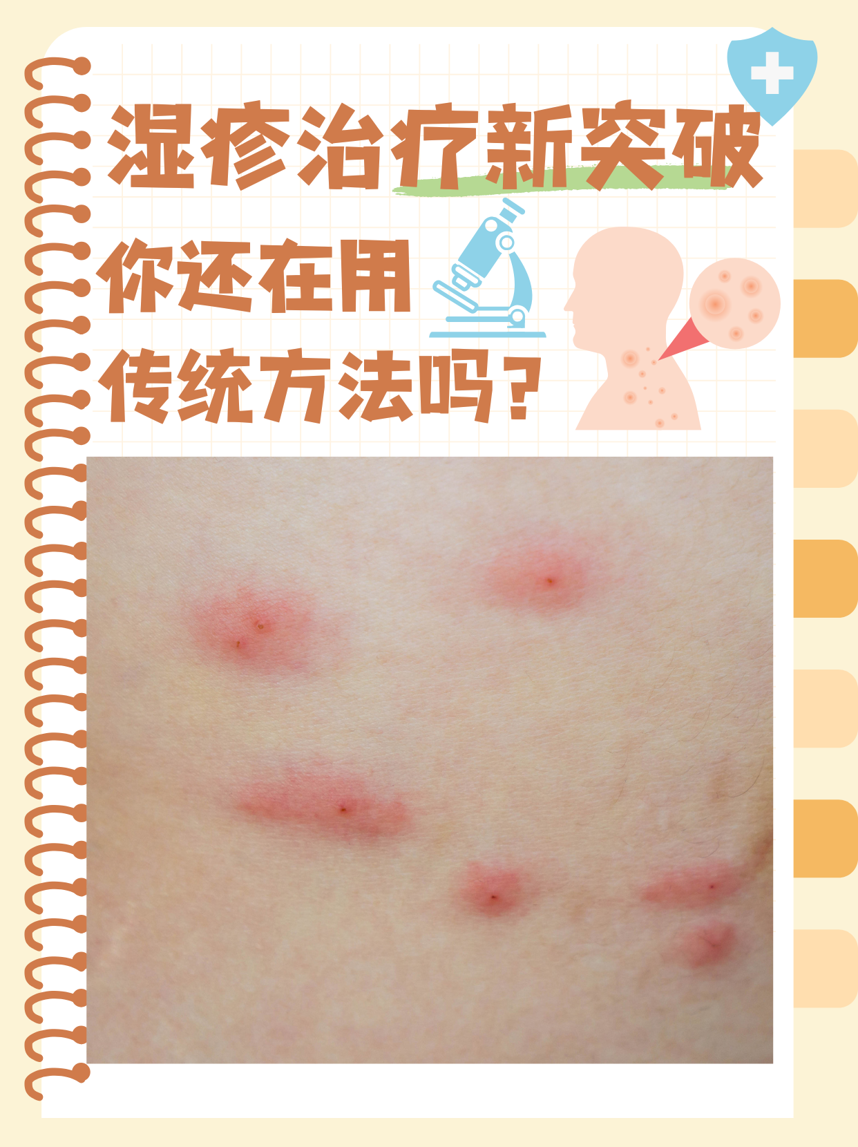 湿疹如何止痒