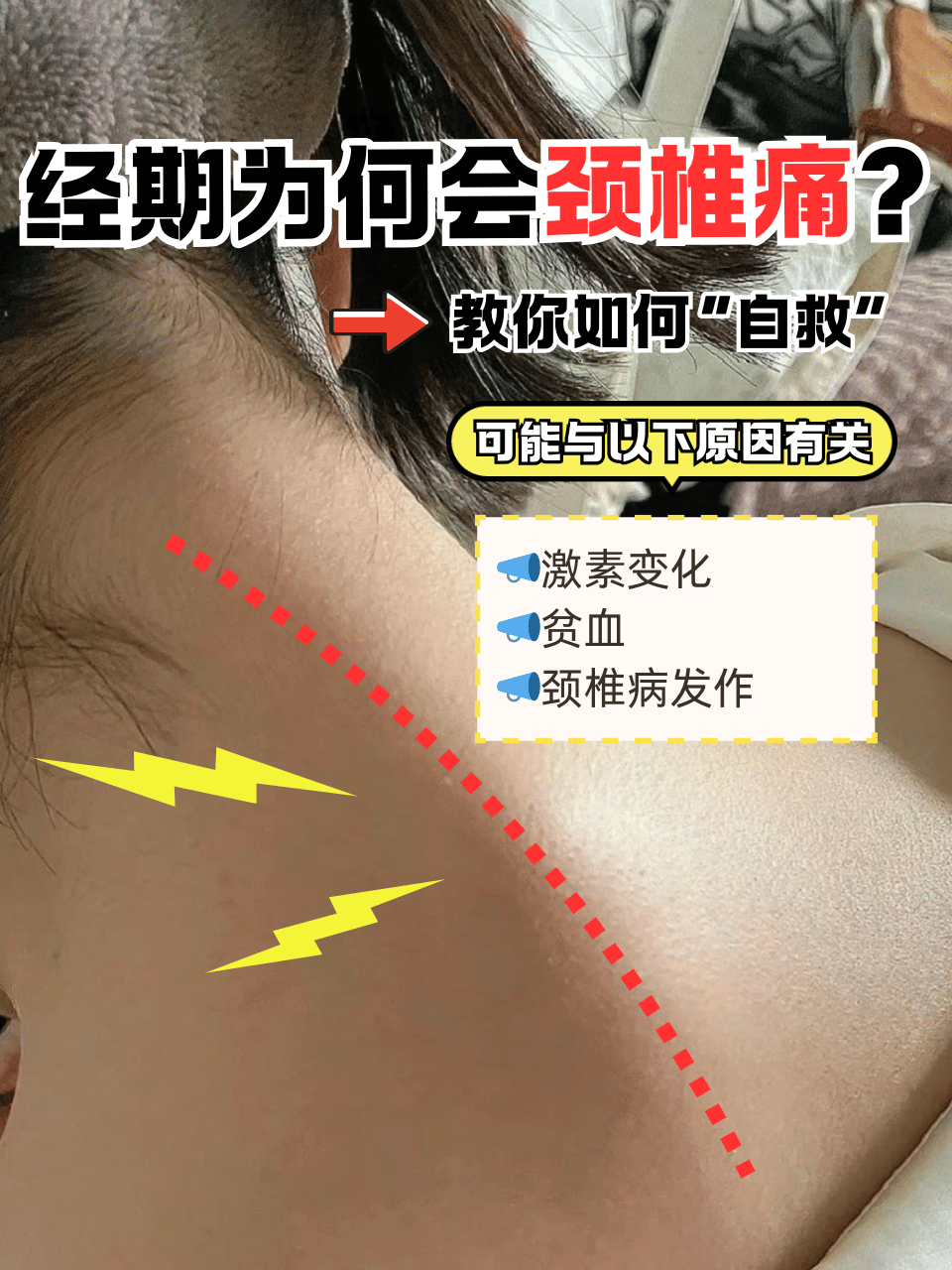 颈椎疼怎么办