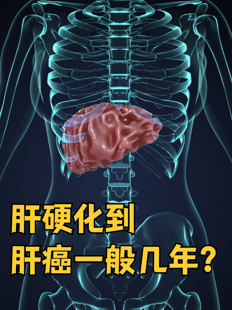 肝硬化晚期能活多久?