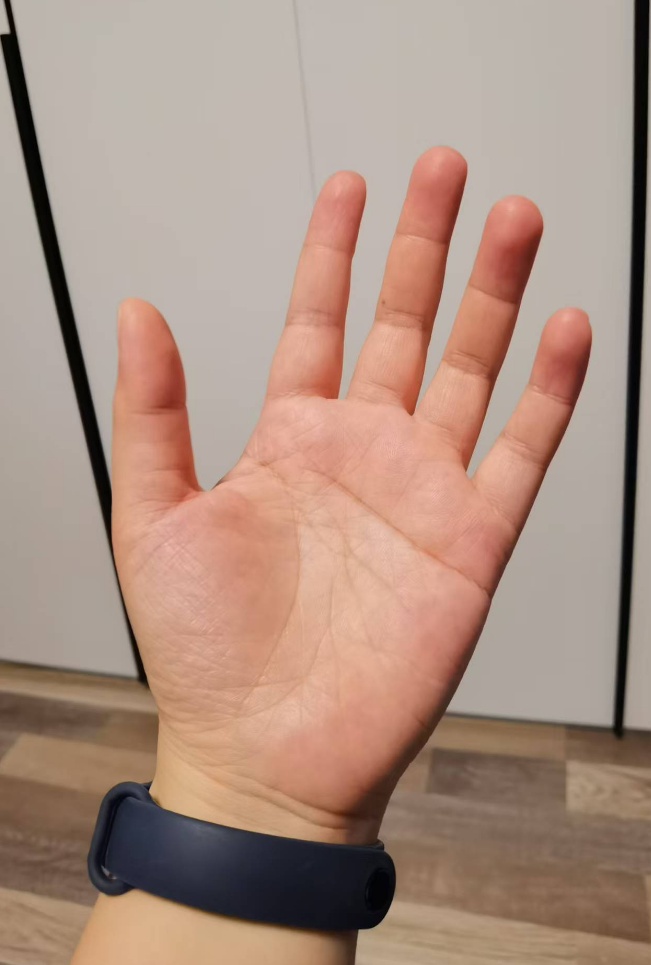 小手指麻木是怎么回事