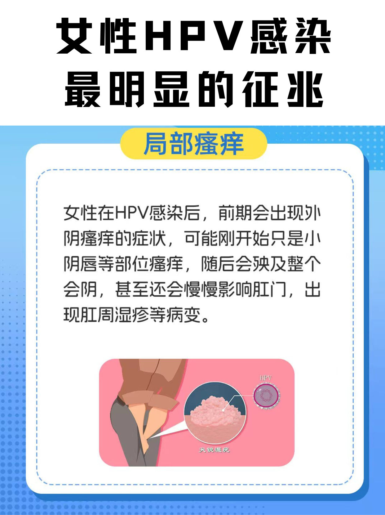 宫颈癌有些什么症状表现?