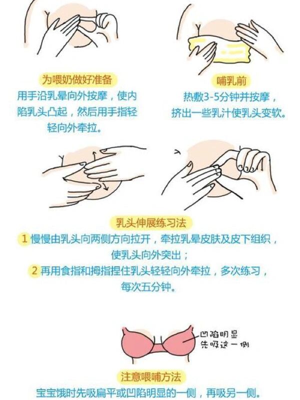 乳头短宝宝吸不到怎么办