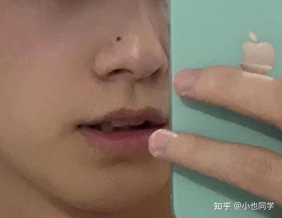 男生什么时候可以刮胡子