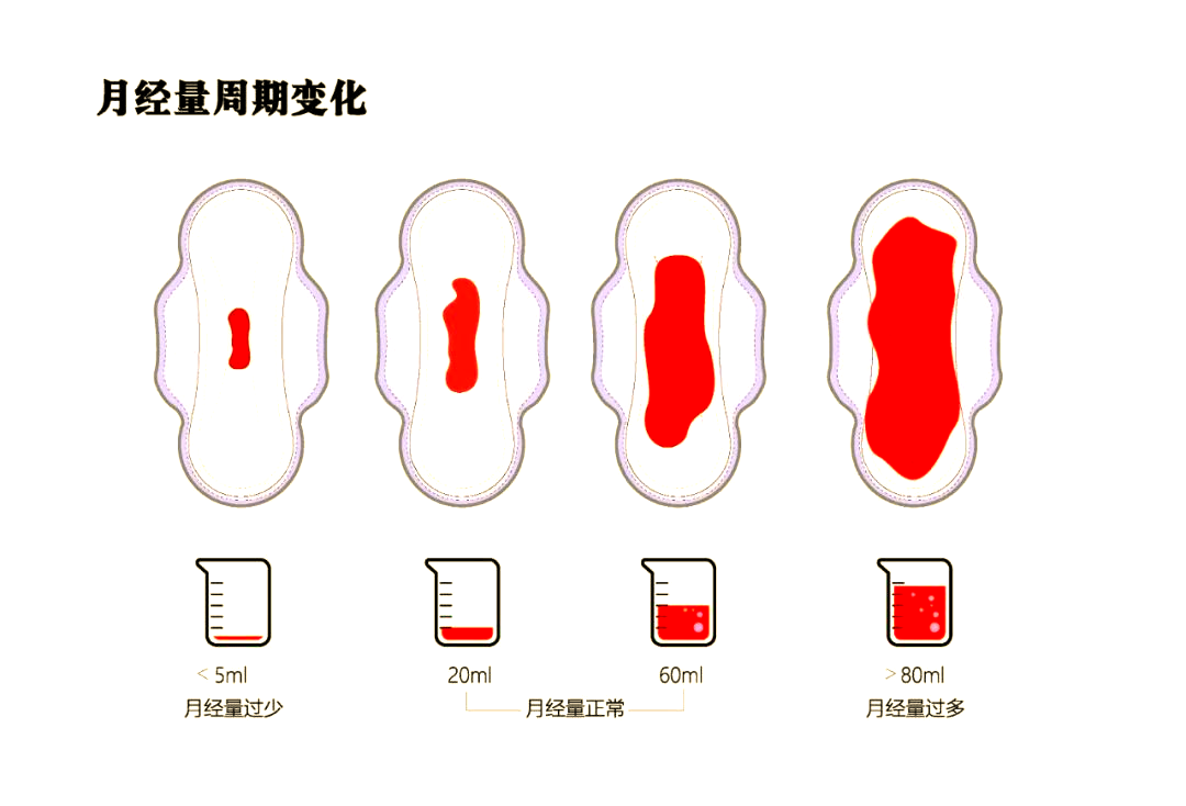 人流后首次月经量很多正常吗