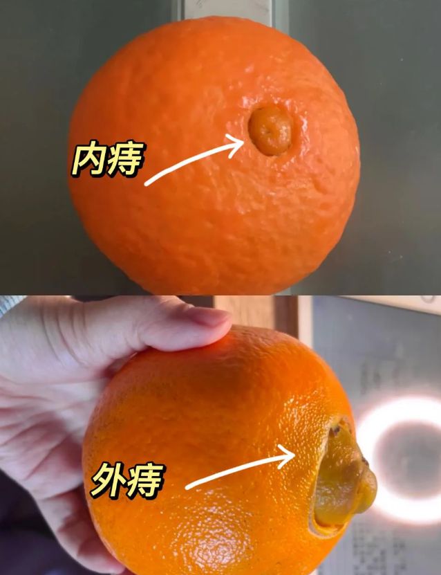 肛门有个肉球一样的东西