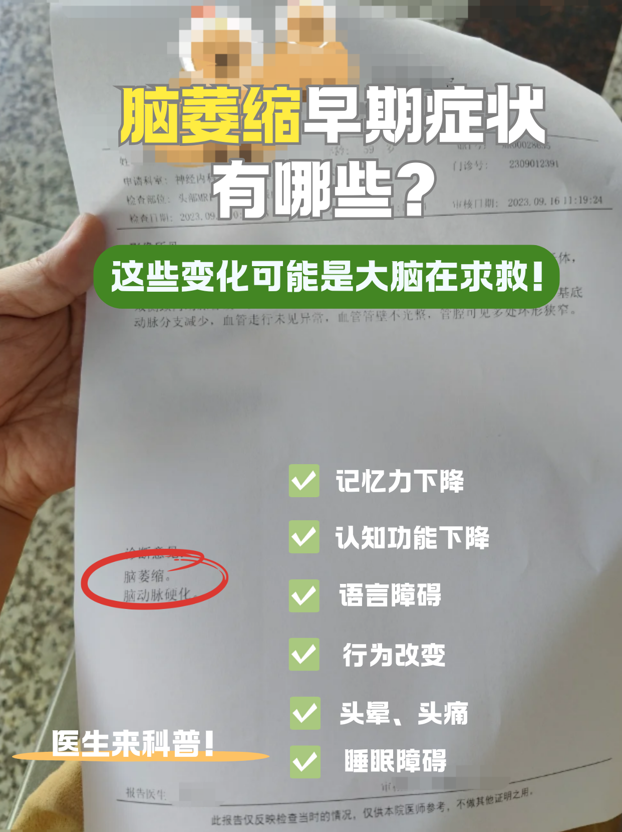 脑萎缩最佳治疗方法.