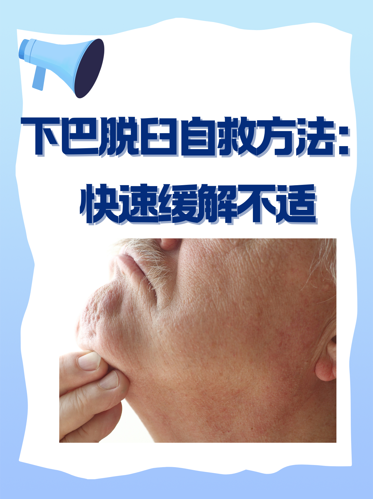 下颌角外翻怎么办