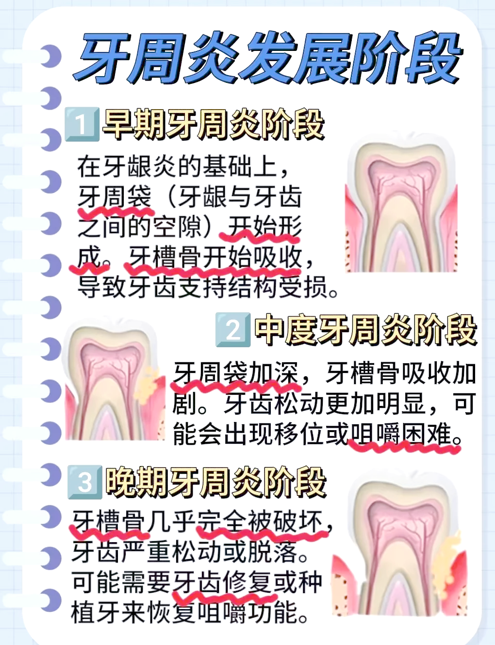 引起牙周炎的原因有哪些