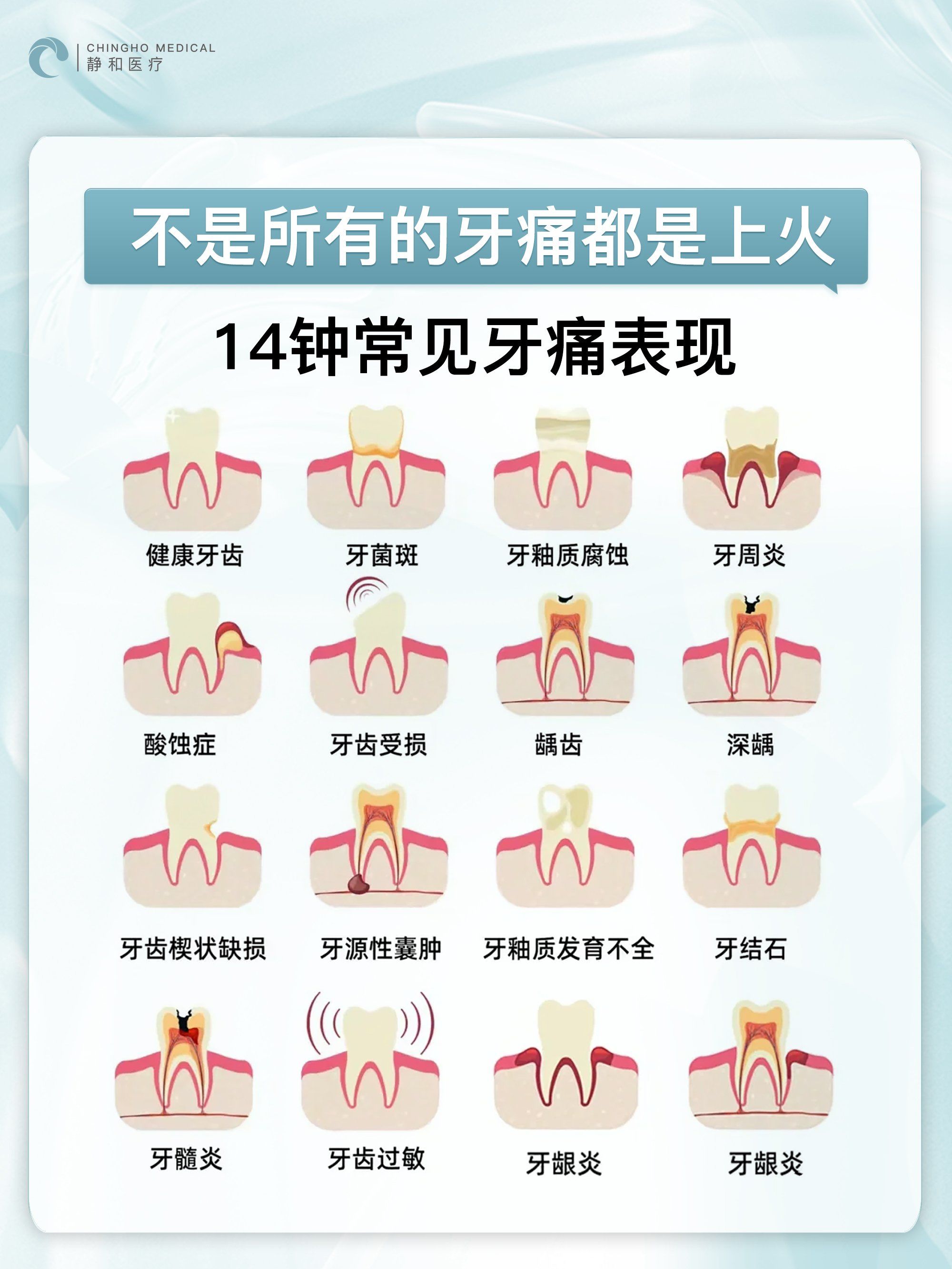 引起牙周炎的原因有哪些
