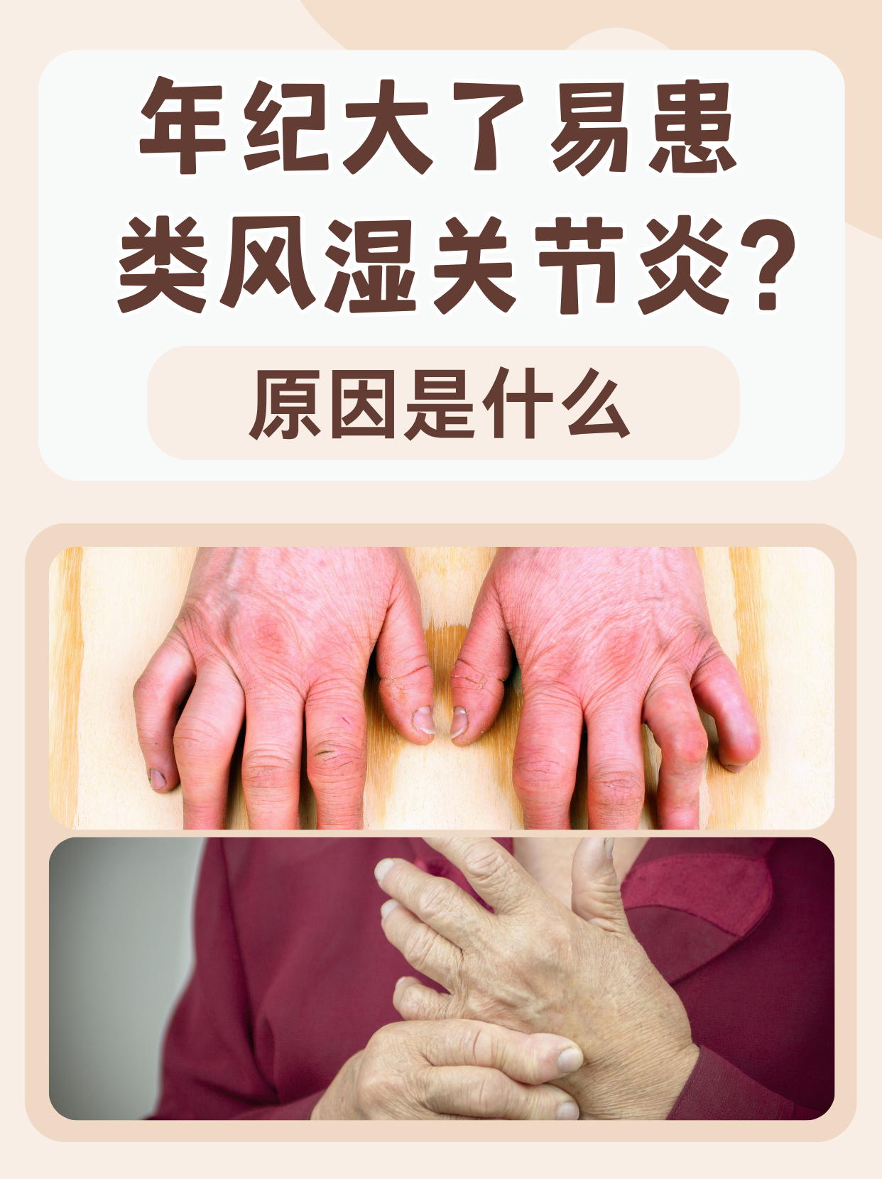 类风湿因子高的危害有哪些