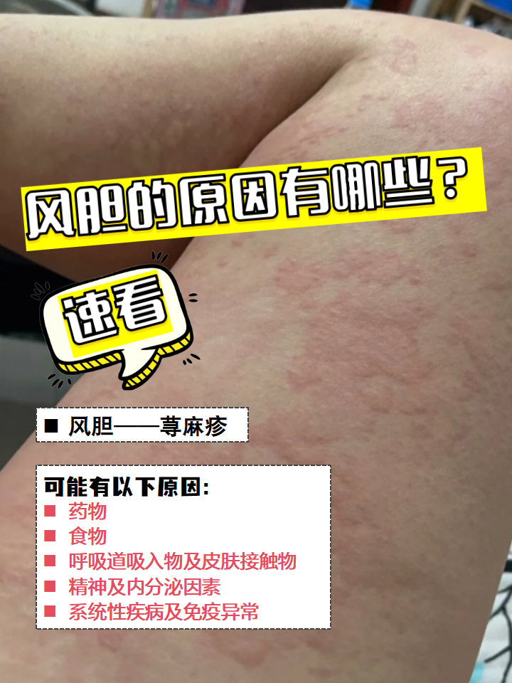 全身痒是什么原因,,