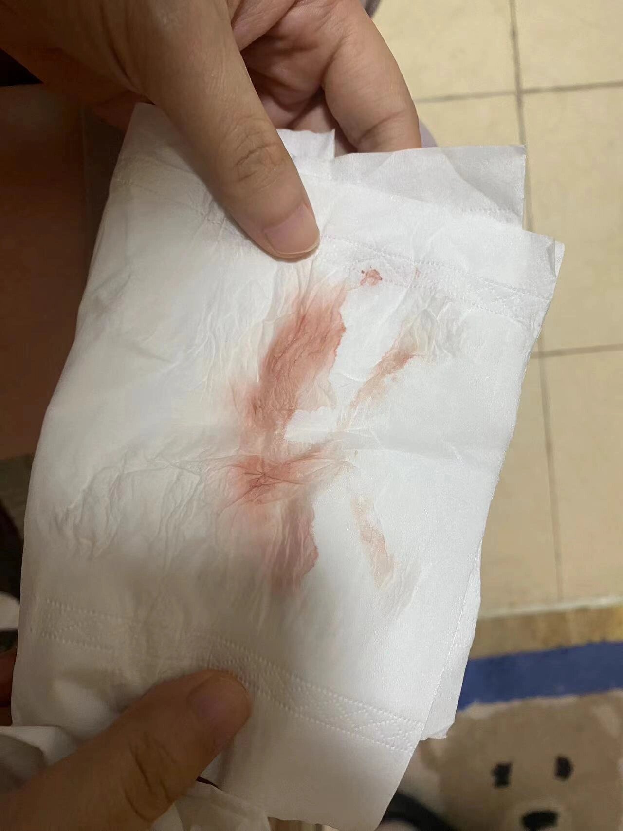 怀孕2个月有出血情况是怎么回事