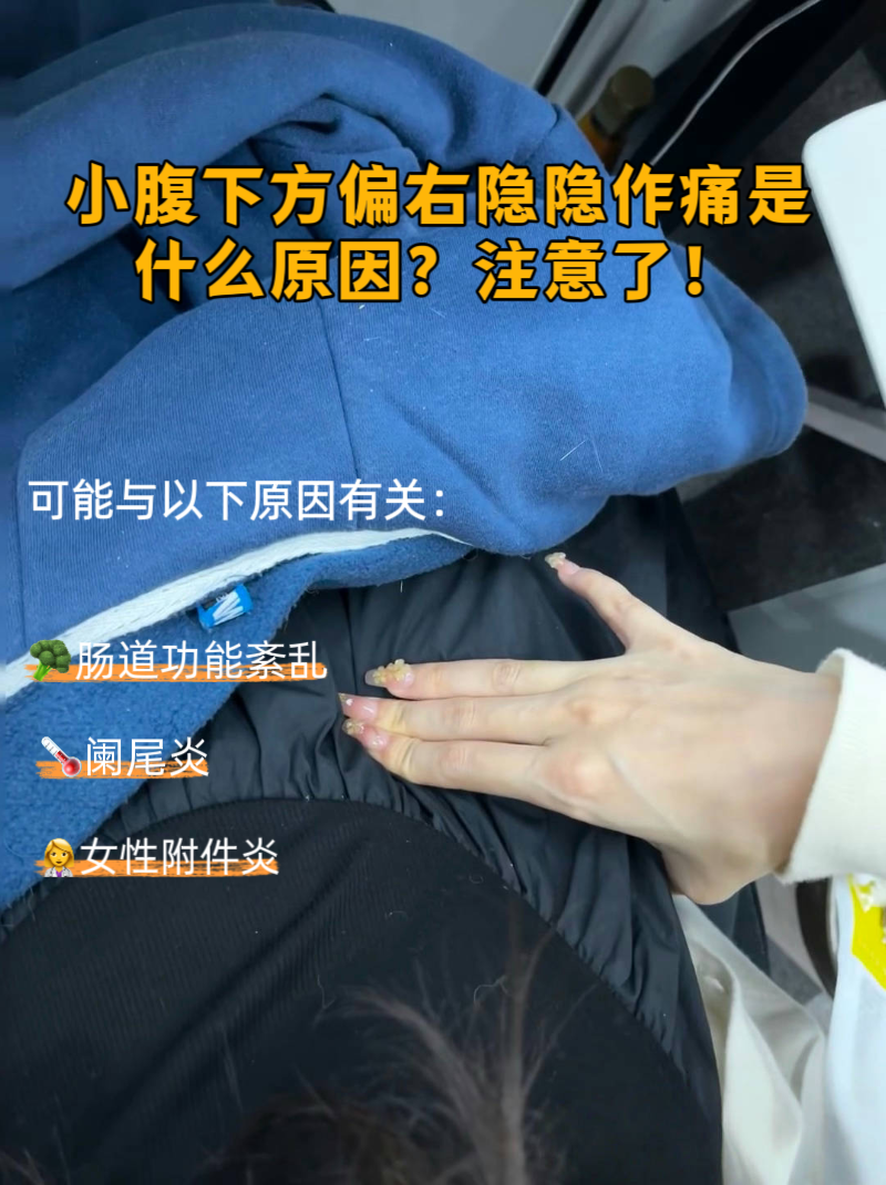 右下腹时不时疼一下,按压不疼