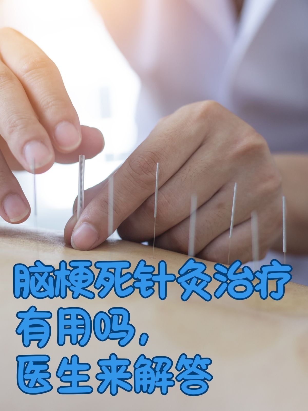 脑梗塞最佳治疗方法是什么?