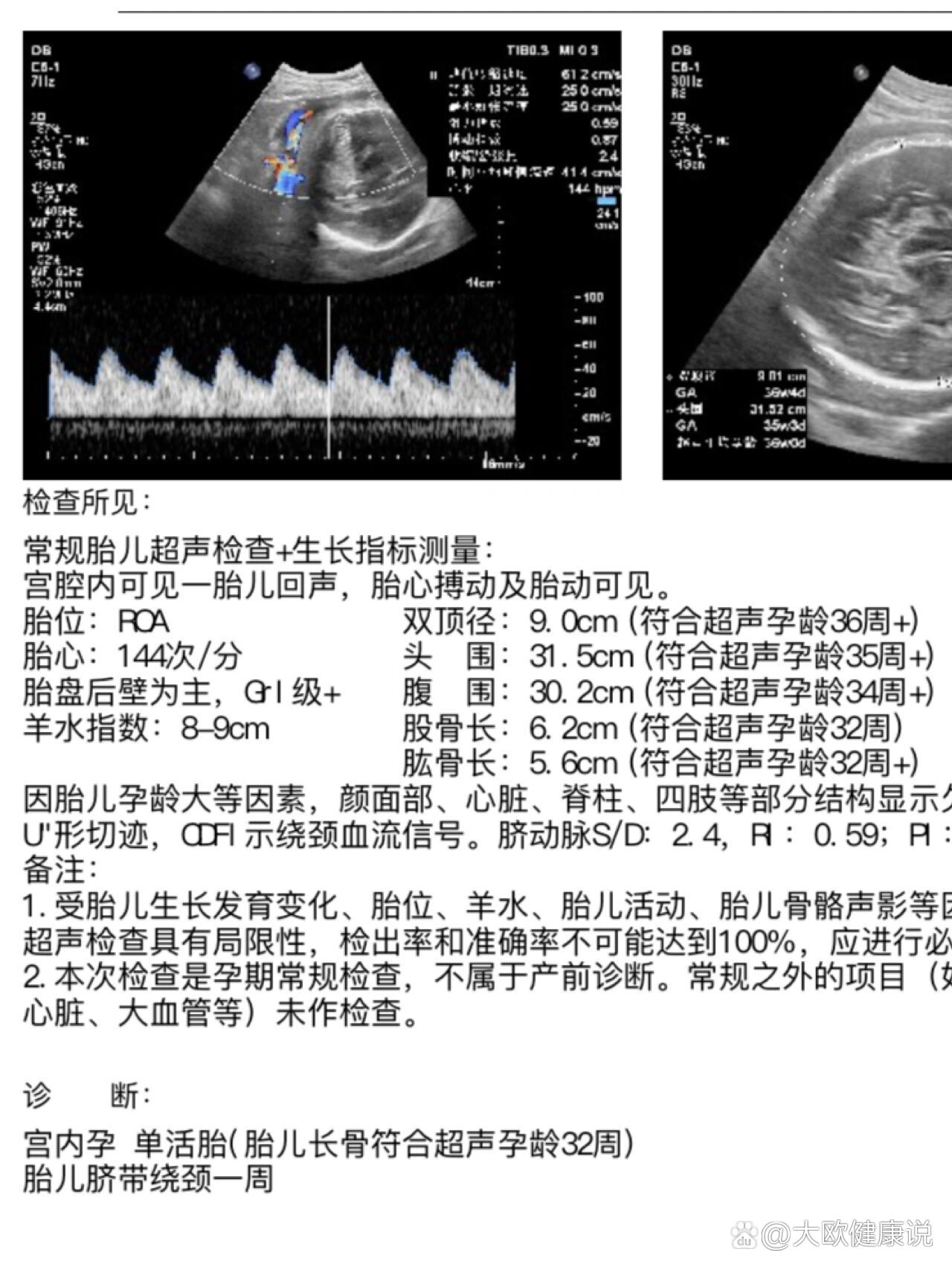 胎儿头大腿短怎么办?