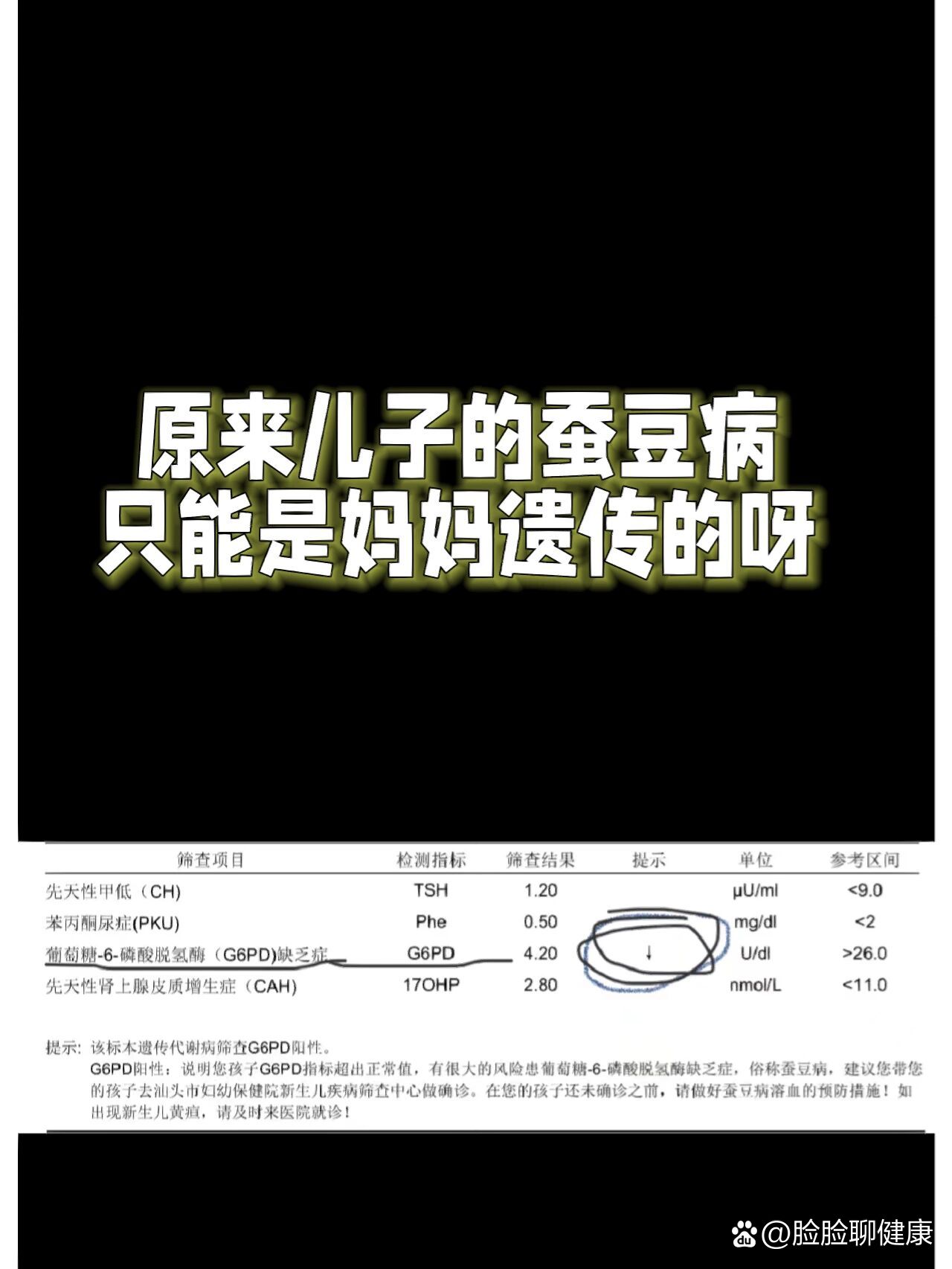 新生儿有蚕豆病怎么回事