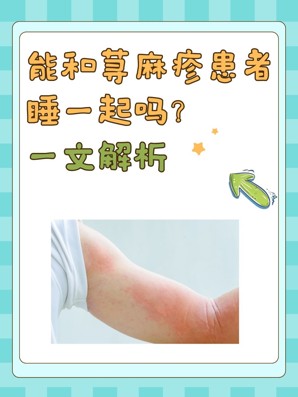 荨麻疹能传染吗