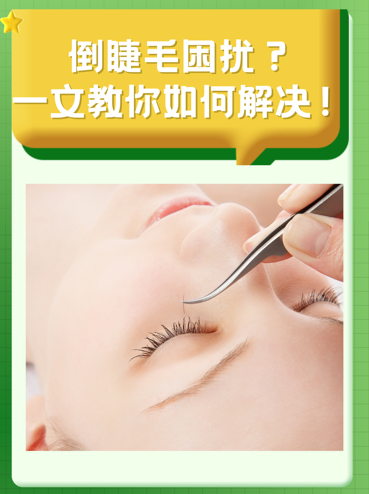 孩子倒睫怎么办