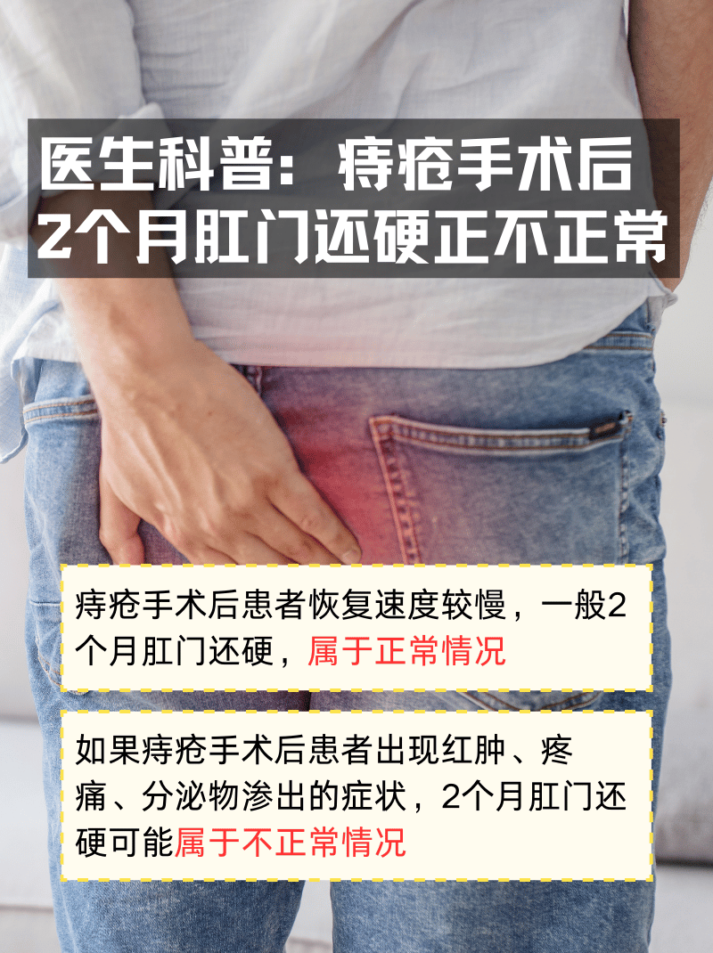 痔疮手术后多久可以同房