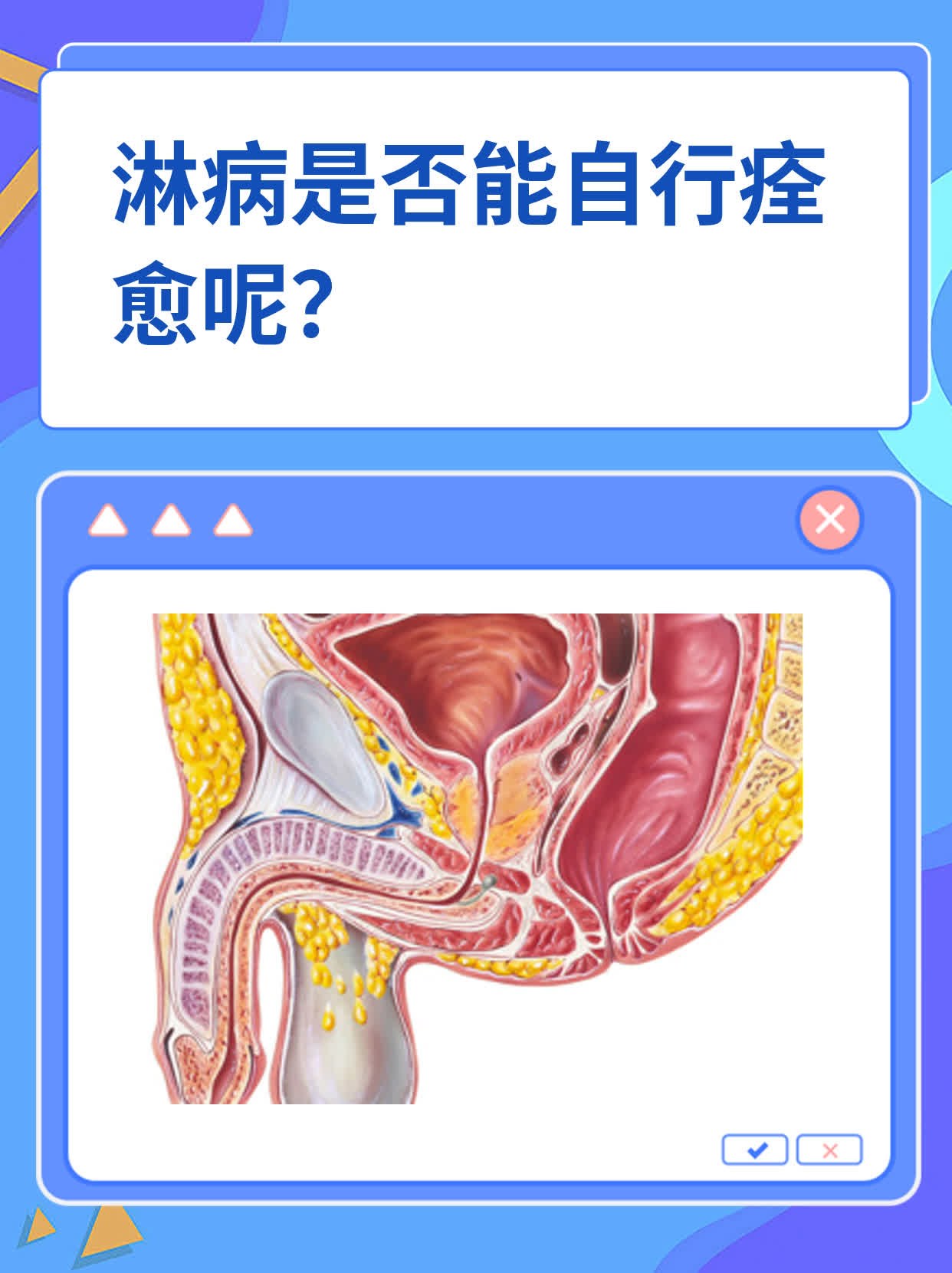 淋球菌是什么病?