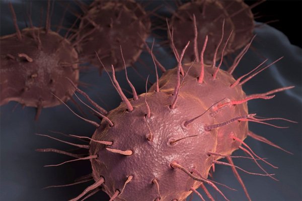 淋球菌是什么病?