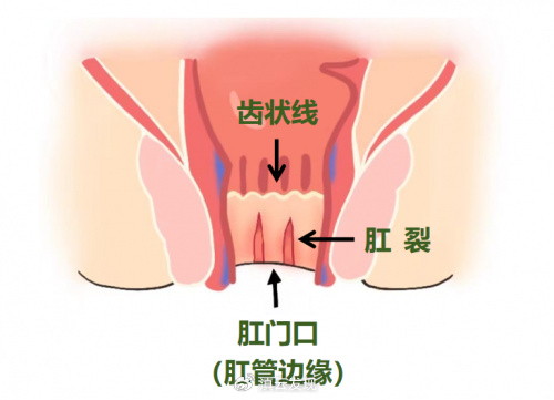 正常的肛门是什么样的