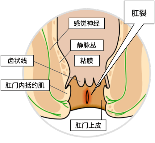正常的肛门是什么样的