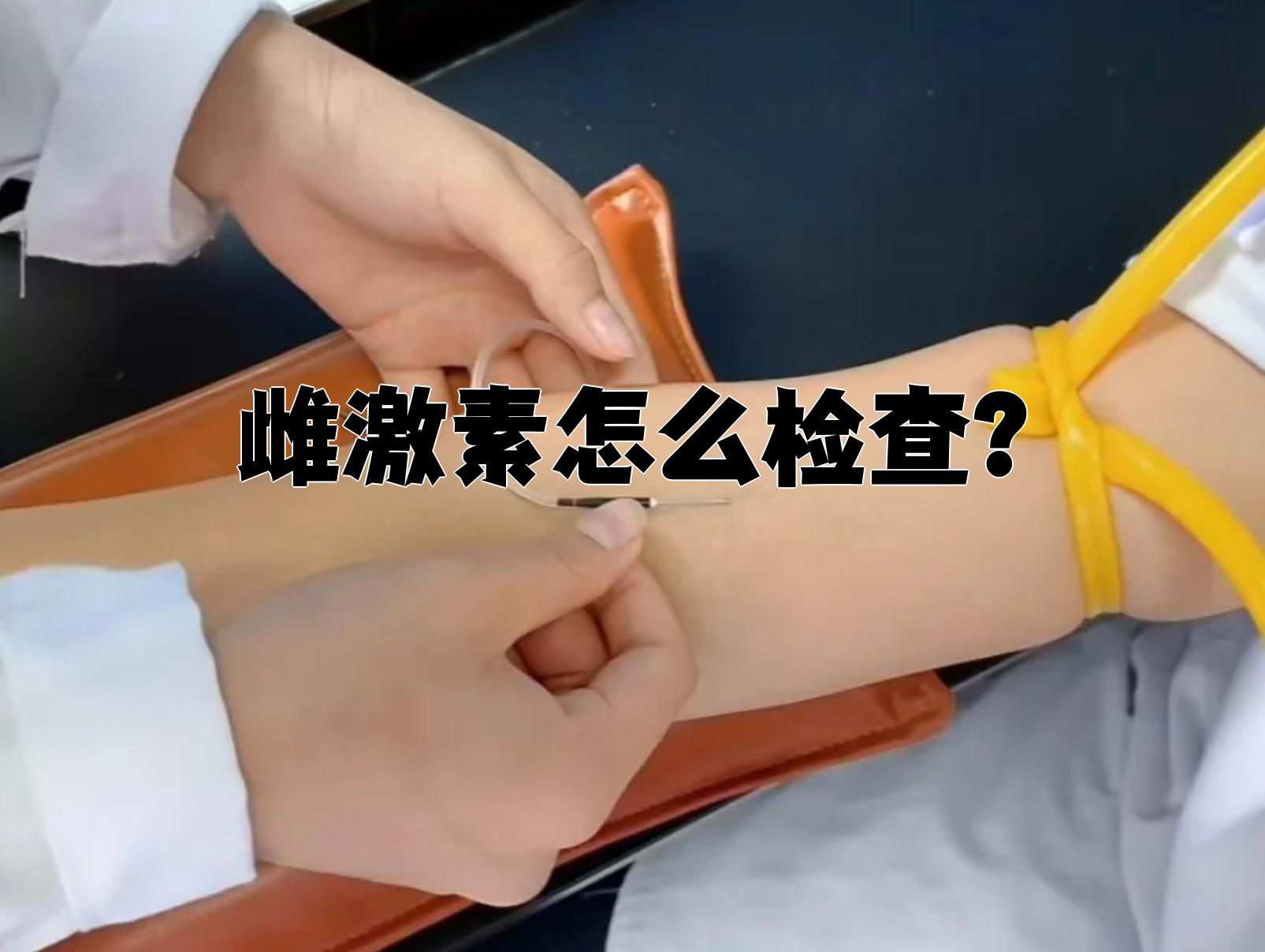 抽血查孕酮需要空腹吗