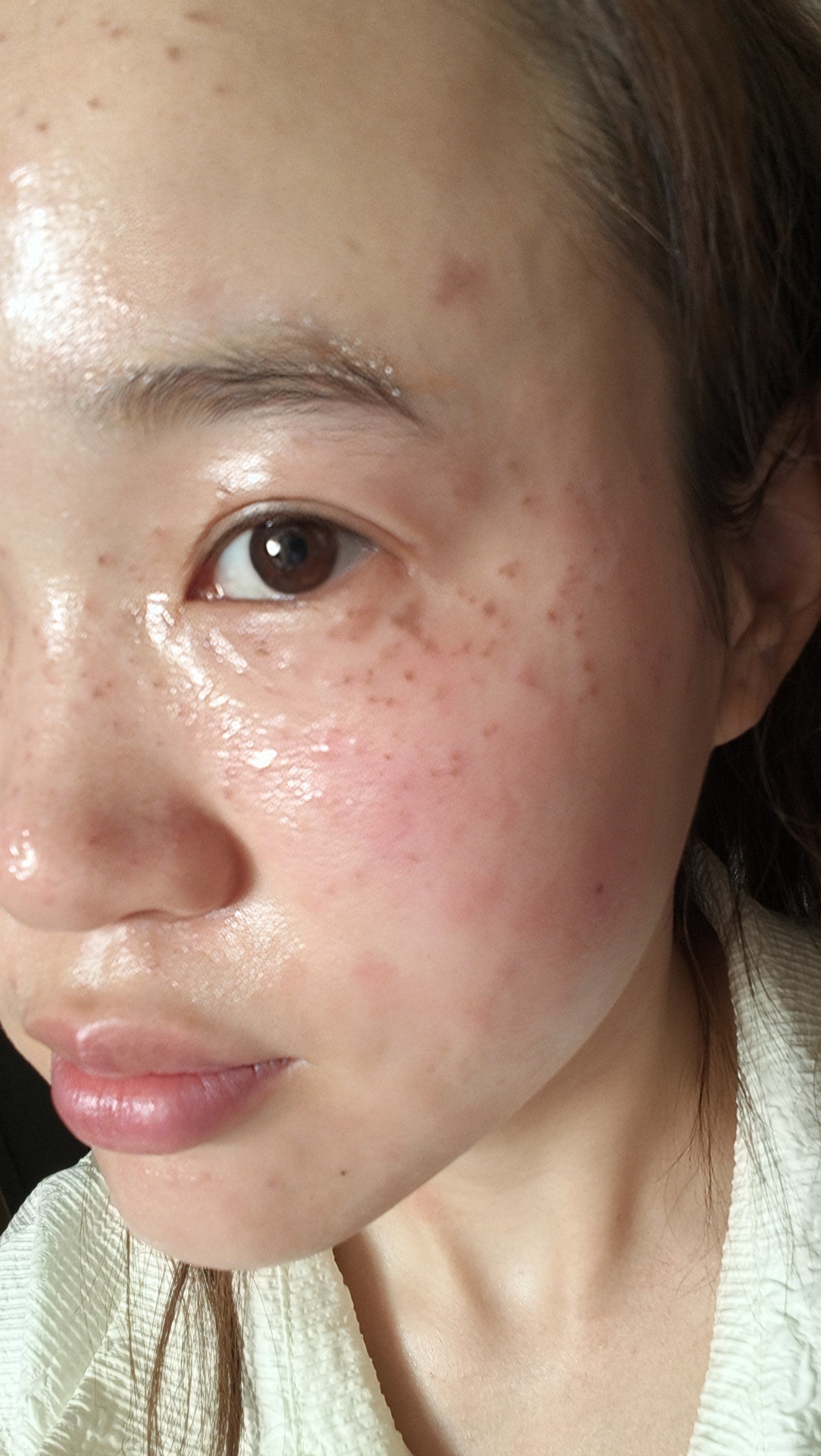 怎么祛斑效果最好