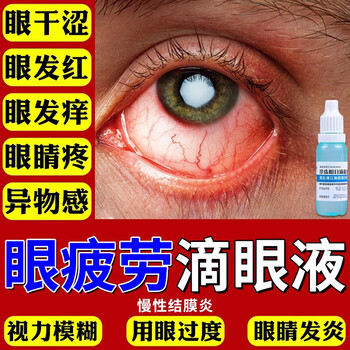 眼睛痒用什么眼药水比较好