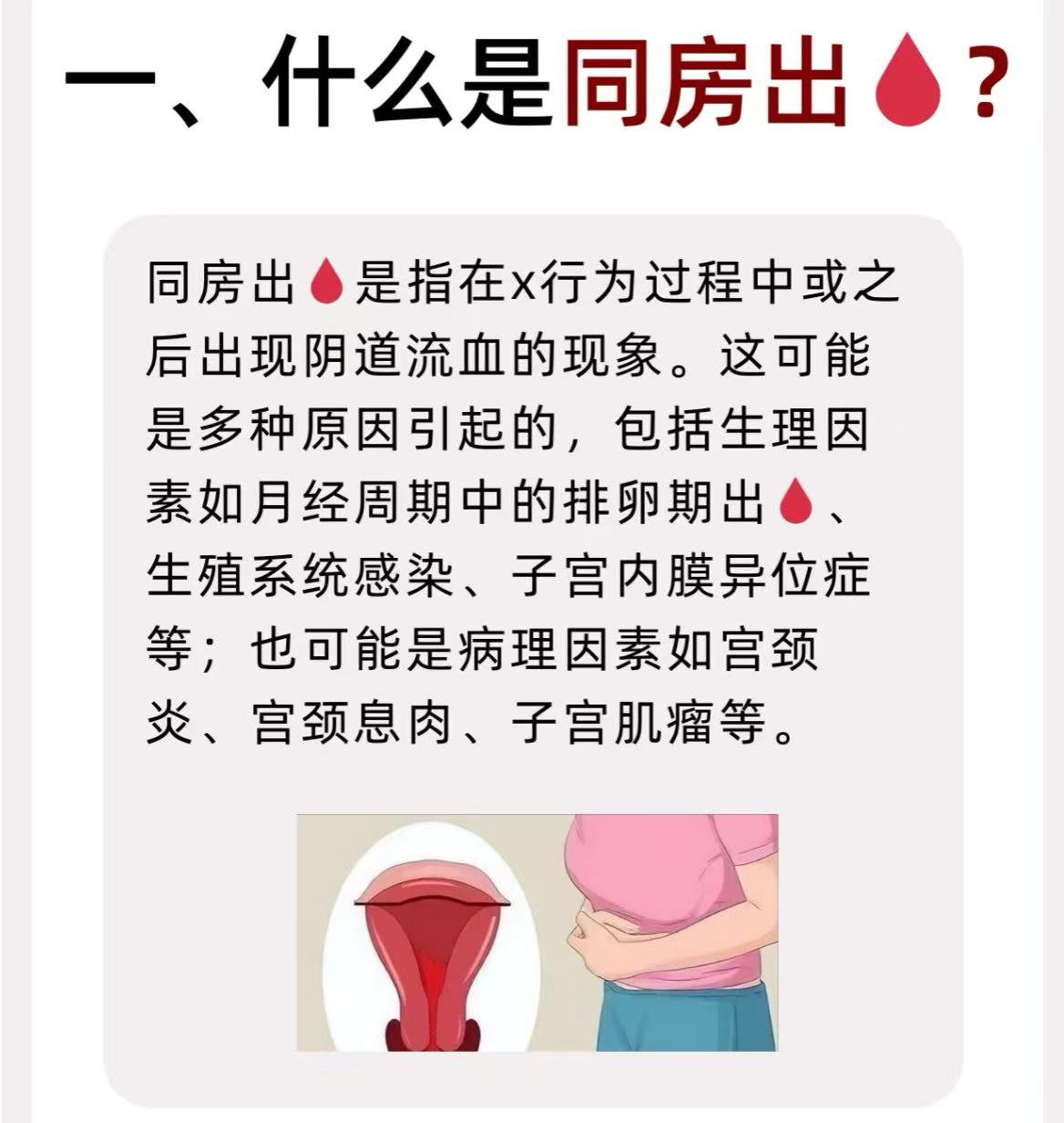 第一次同房为什么没流血