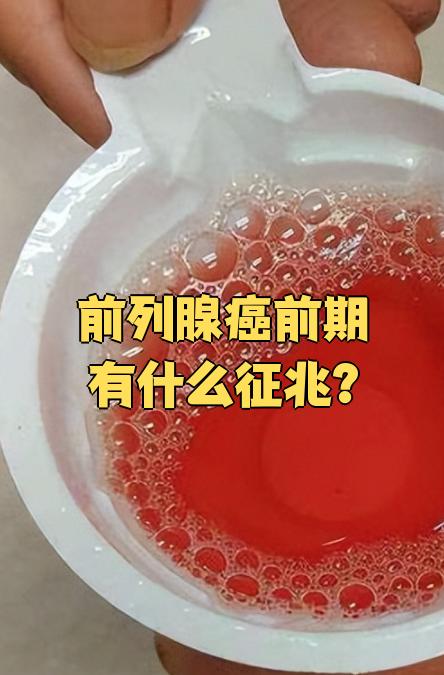 前列腺癌去世痛苦吗