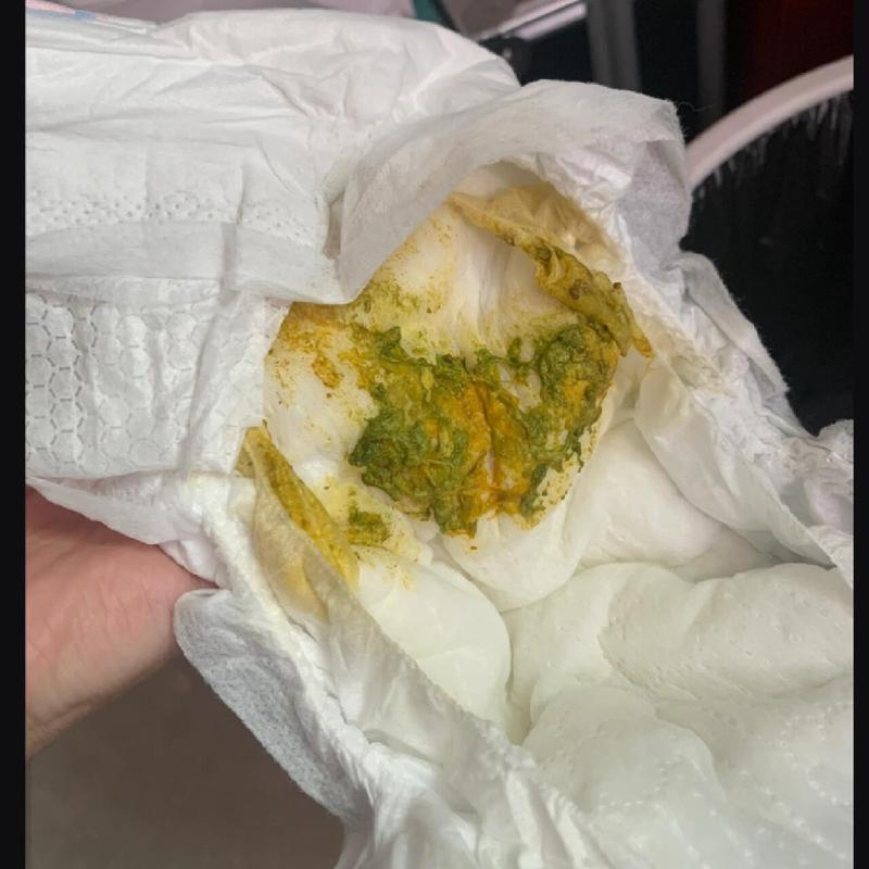 宝宝拉绿便便