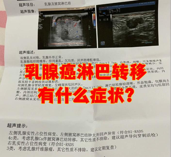 乳腺癌淋巴转移怎样办