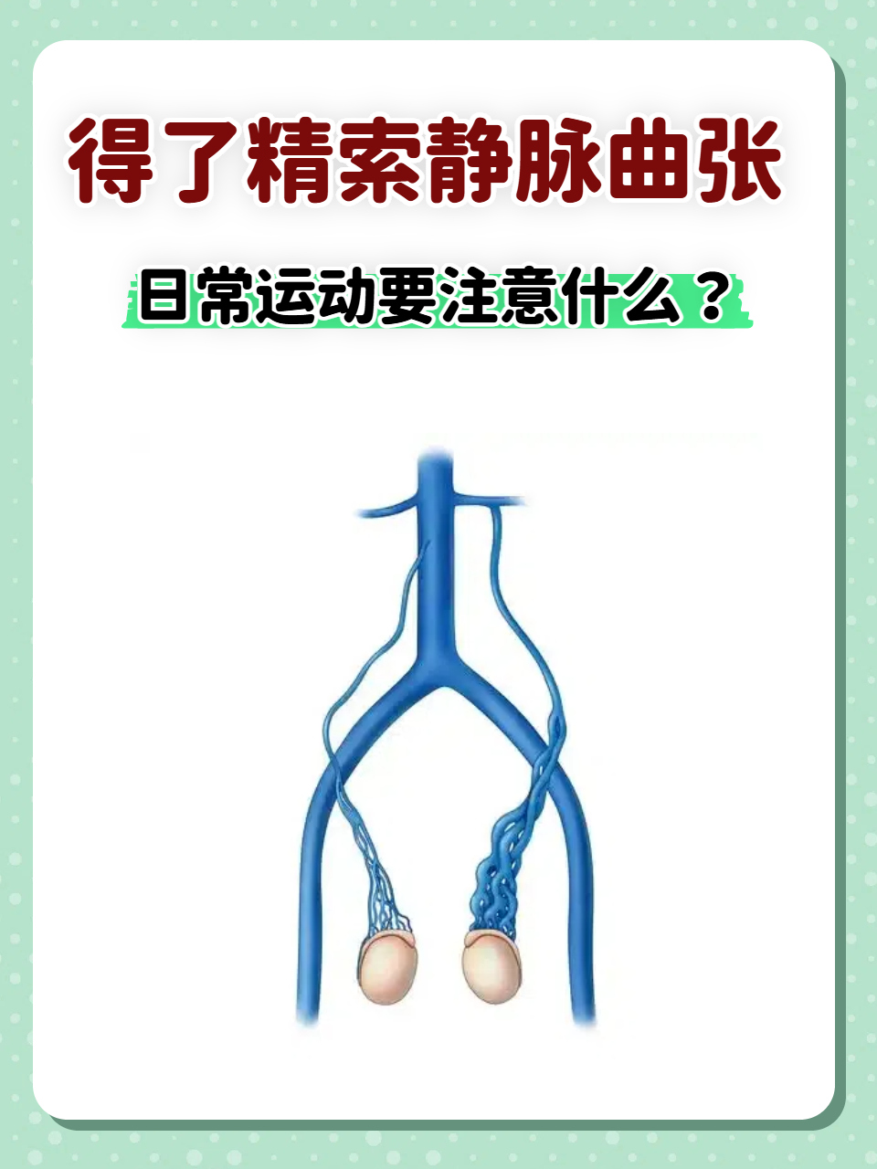 精索静脉曲张的原因是什么