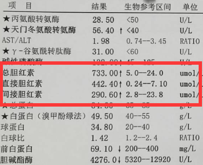 结合胆红素正常值是多少