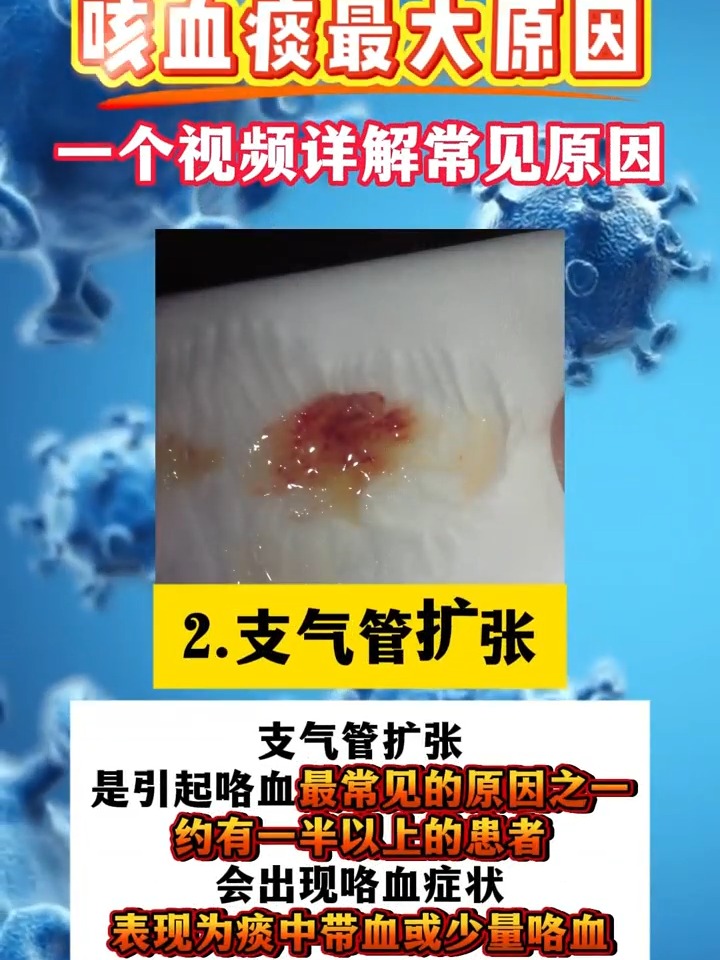 肺癌患者咳血怎么治疗