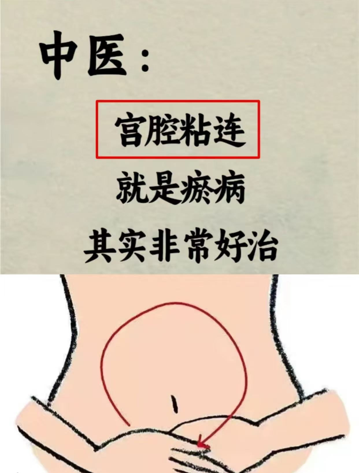 盆腔粘连是怎么引起的