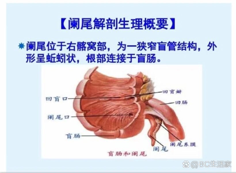 阑尾是什么