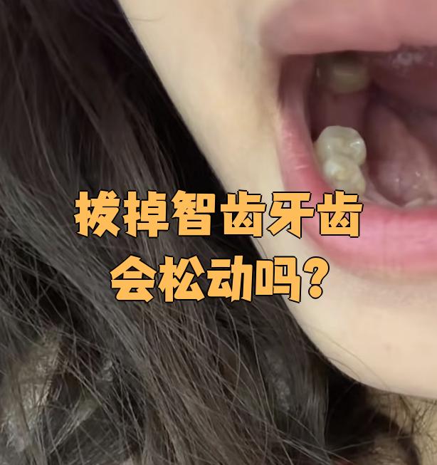 什么样的智齿需要拔?