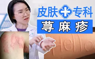 避孕套过敏什么症状