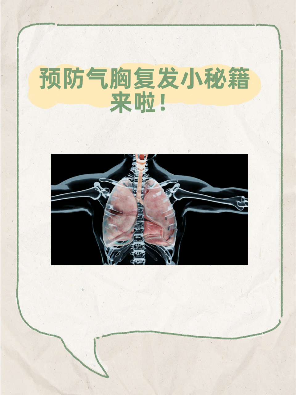 气胸怎么护理