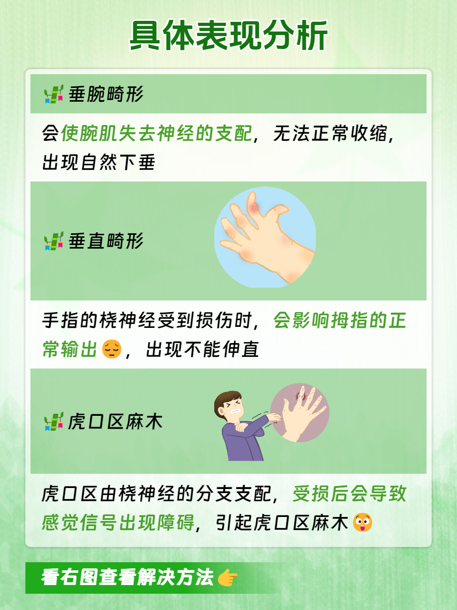 桡神经损伤的表现在哪些?