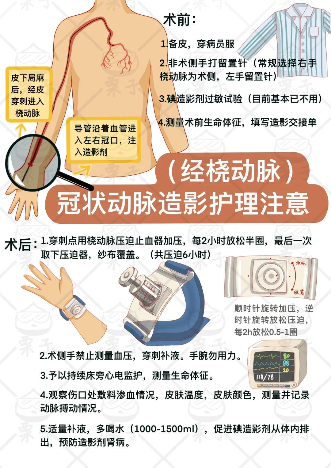 如何进行造影检查
