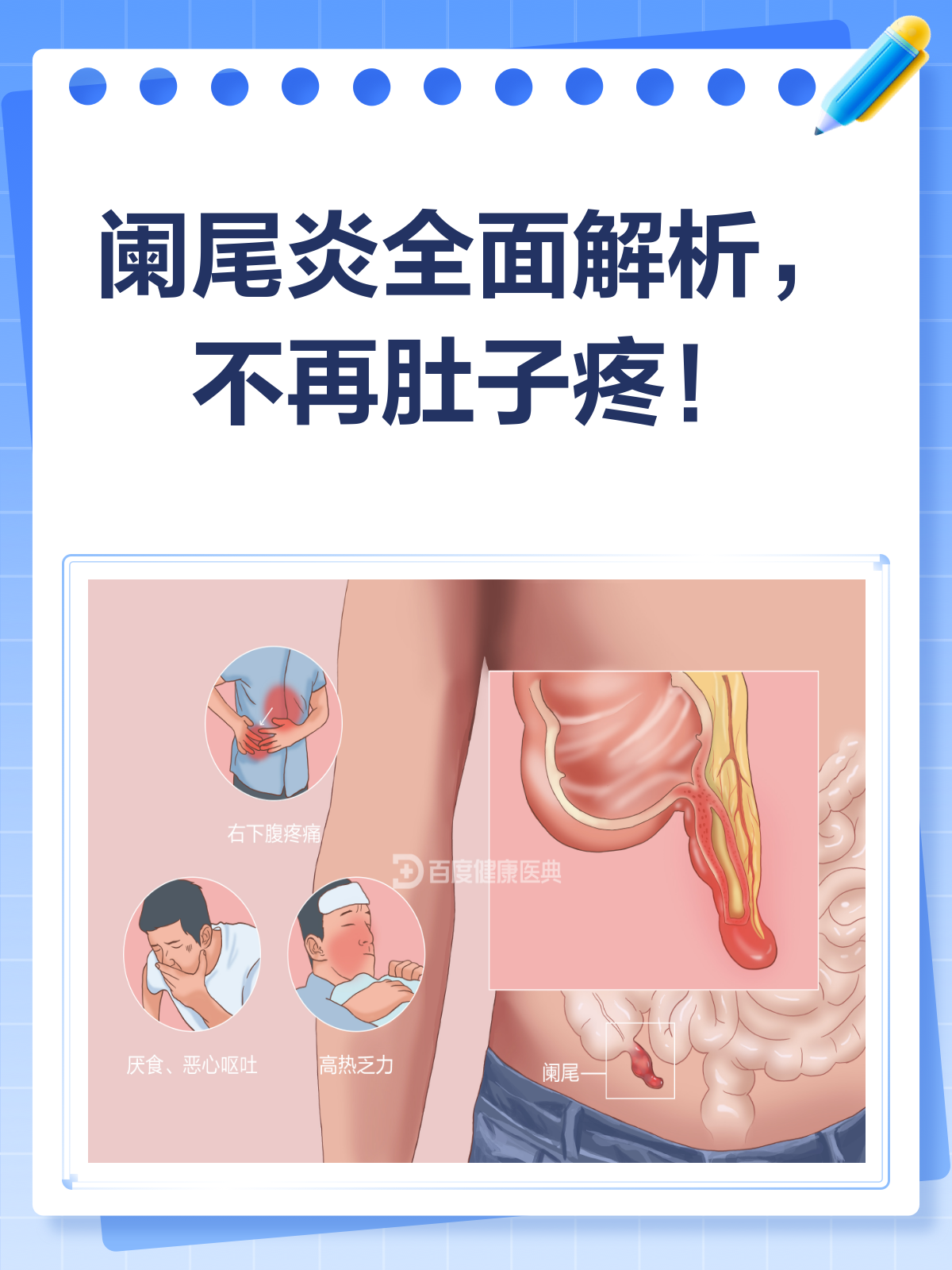 阑尾炎是由什么原因引起的