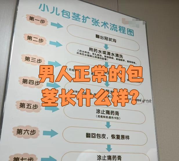 男人的包皮是怎样的图片
